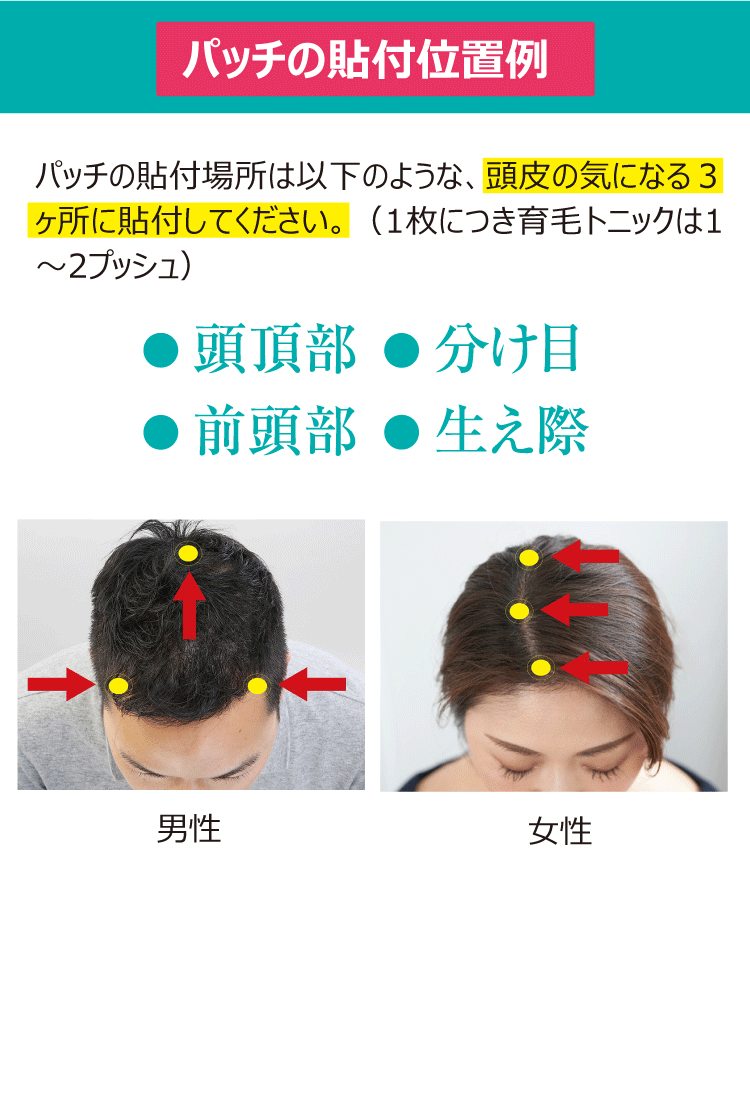 パッチの貼付位置
